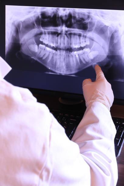Best Emergency Treatment for Toothache in Akron, OH